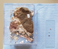 M 05713
<br/>
radiaalstralige en bloemige Erythrien op veldspaat -rijkepegmatiet
<br/>
<em></em>